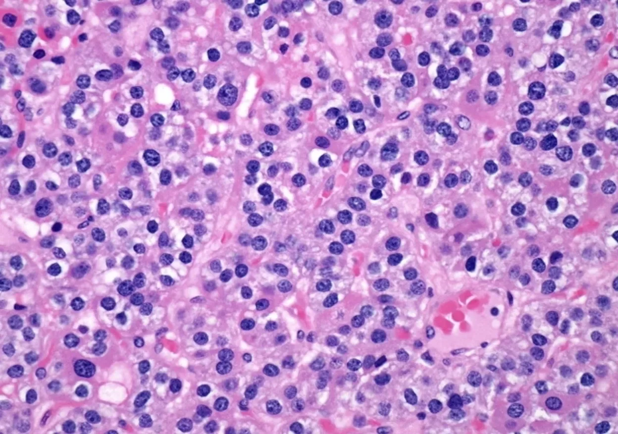 Microscope image of stained parathyroid tissue