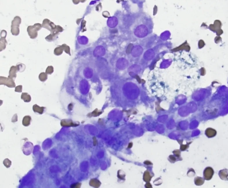 Microscope image of thyroid cells from a needle sample