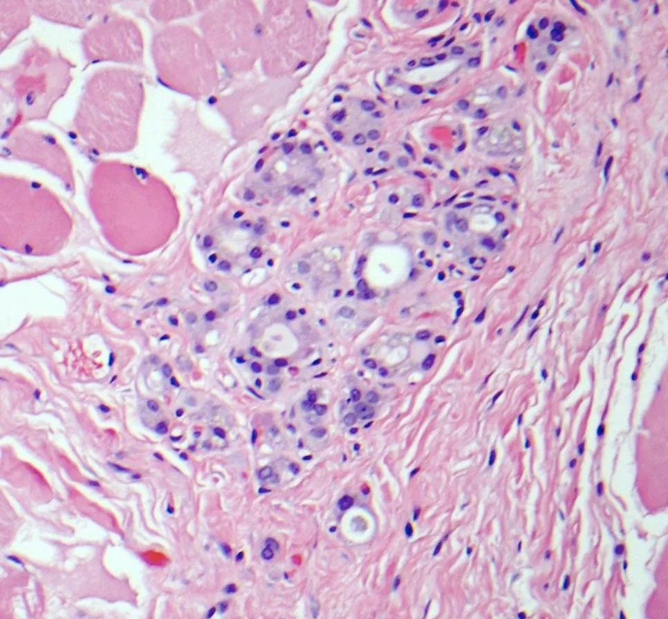 Microscope image of stained thyroid tissue