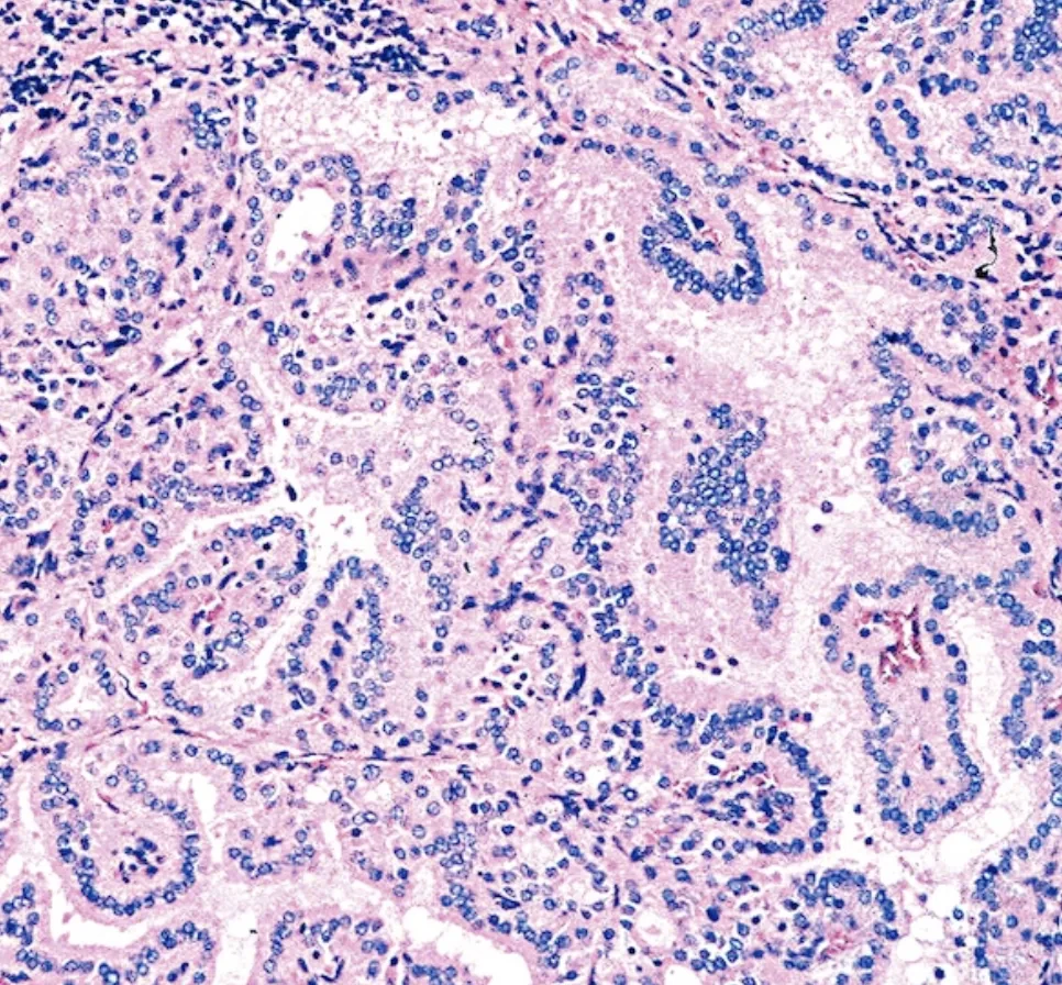 Microscope image of stained thyroid tissue with branching structures