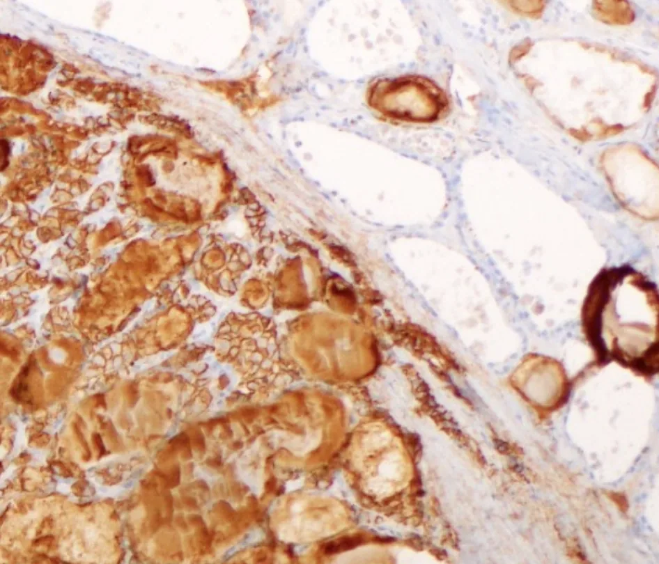 Microscope image of thyroid tissue with brown special staining