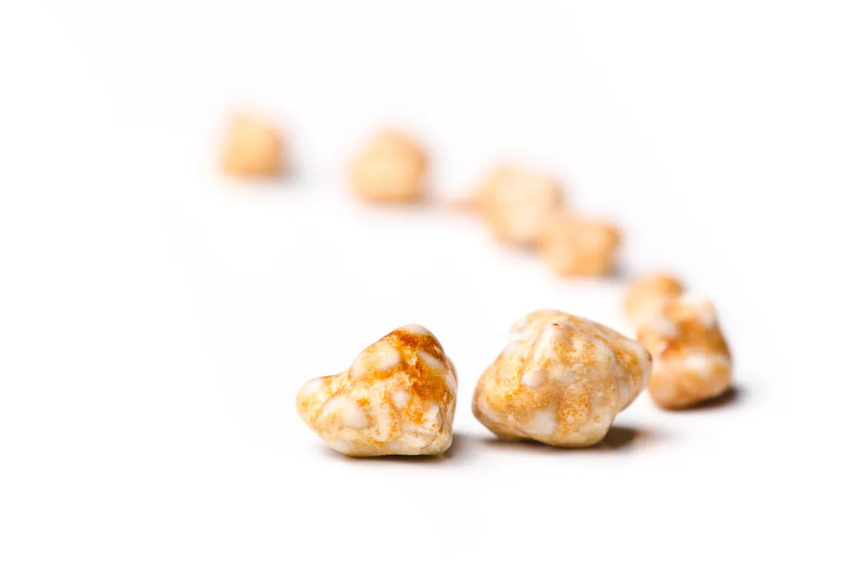 Close-up of several yellow-brown gallstones on a white surface